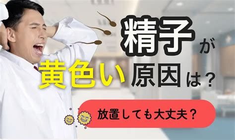 精子がゼリー状|精子が黄色い原因はなに？放置しても大丈夫なのかを。